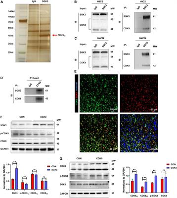 CDK9 binds and activates SGK3 to promote cardiac repair after injury via the GSK-3β/β-catenin pathway